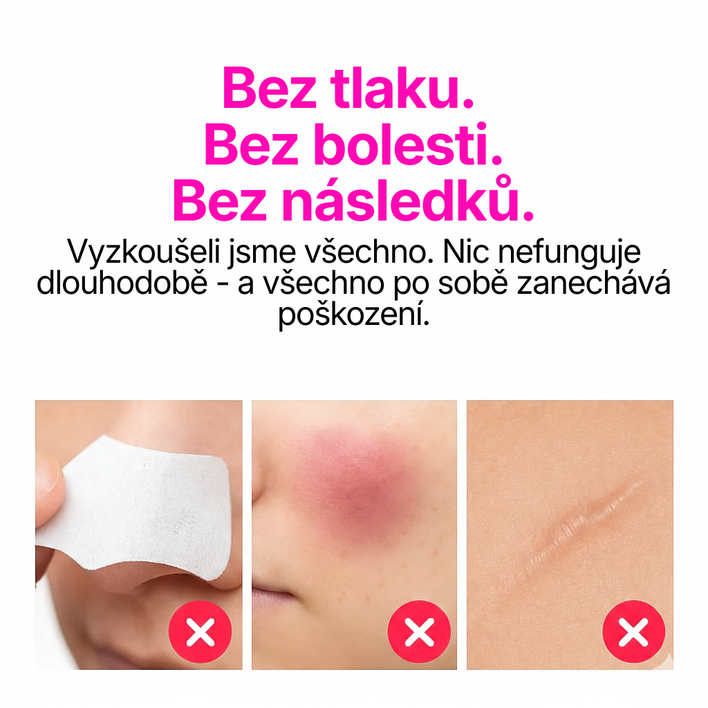 Skinforce: Vakuový vysavač pórů